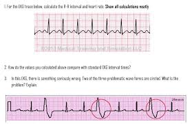 Check spelling or type a new query. 1 For The Ekg Trace Below Calculate The R R Interval Chegg Com