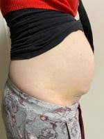 Die dauer des wochenflusses variiert stark zwischen 3 und 12 wochen Frage An Kaiserschnitt Mama S Zum Bauch Forum Geburt Wochenbett Urbia De