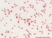 Bacteria for microlab final pics Flashcards | Quizlet