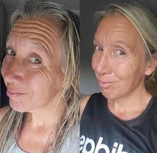 One week left of AgeLOC Boost at 51% off 😭 Our skin booster device is  going back up in price. Have you had your eye