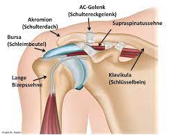Teilentfernung Schultereckgelenk Ac Gelenkresektion