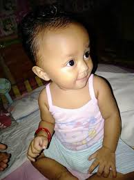 Morng guyz I need ur prayers,I got alergy since ystrday