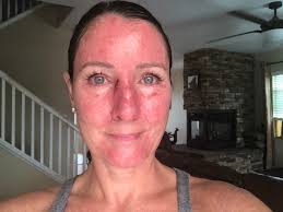 Real-life 'mermaid' who lay