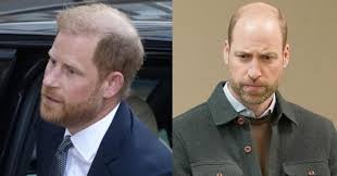 Prince Harry Admits He's Going Bald ...