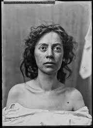 See These Stunning Photos Of Brain Surgery S Earliest Patients Brain Surgery Portrait Portraiture
