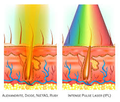 Rates can range from single sessions at $50 each for smaller parts of the body such as fingers and toes to upwards of $200 for a full arm and leg. Laser Hair Removal Versus Electrolysis Hair Removal Electrolysis Beauty Lounge