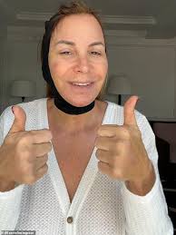 Real Housewives Of New York City alum Jill Zarin, 60, had a facelift, chin  implant and fat transfer to give her a 'more youthful look'