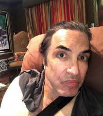 Kiss Frontman Paul Stanley In Tendon Surgery