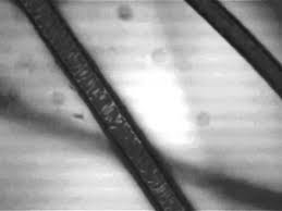 Ringworm in cats is caused by a fungus and is similar to athlete's foot in humans. Strange Structures Seen In Cat Hair Under A Microscope Youtube