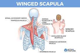 Image result for Winged Scapula
