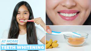 While many people aim for the sparkliest smile they can achieve, whiter teeth don't actually equal healthier teeth. 5 Home Remedies To Whiten The Teeth At Home In A Day