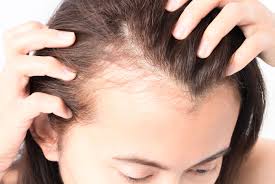 It is quite embarrassing for most women to have hair on face. Hair Loss Alopecia Treatment Gynaemd Women S Rejuvenation Clinic