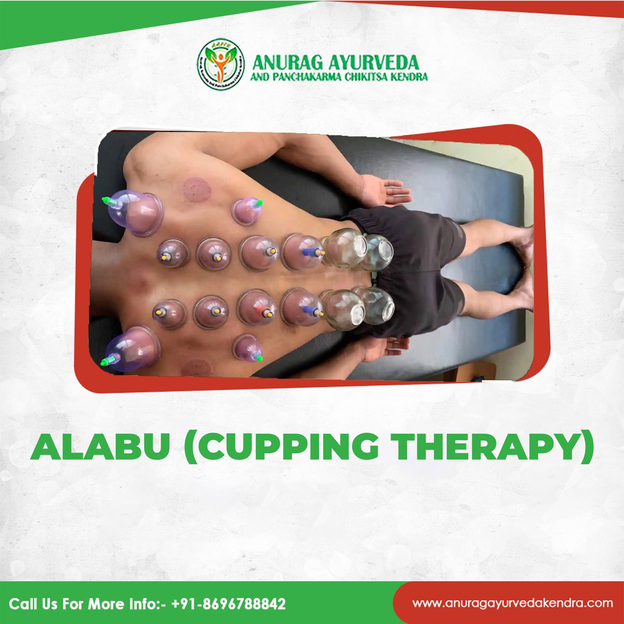 Alabu (cupping therapy) product image