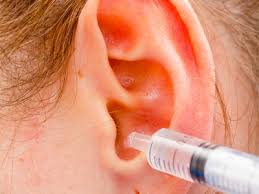 Le cérumen est une substance naturelle produite par notre organisme pour empêcher des si vous voulez connaître toutes les caractéristiques de ces traitements naturels, continuez notre article comment enlever un bouchon d'oreille. Le Lavage D Oreille Pratique Infirmiere