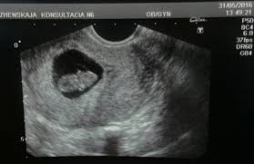 Check spelling or type a new query. 3 Month Pregnancy Pictures Novocom Top