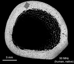Two types of bone tissues in cross section of a long bone : Multiscale Elastic Imaging Of Bone