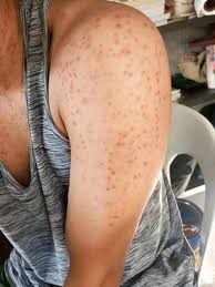 These are the consequences of sleeping with the… See more