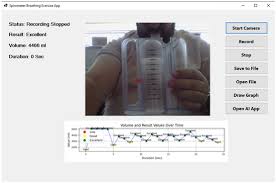 Image result for Exercise Spirometry
