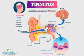 Previous tennitus louder after ear infection / tinnitus sufferer can finally sleep after listening to. Tinnitus Causes Symptoms And Treatment