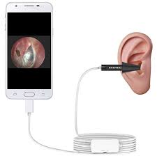 Top 8 Most Popular Medical Ear Camera List And Get Free Shipping A649