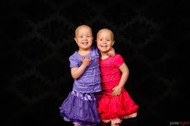 Twins With Leukemia Twins Down Syndrome Twin Girls