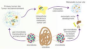 Image result for Primary Tumor Localization