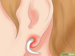 Como Tratar Una Infeccion En Orejas Recien Perforadas In 2020 Infected Ear Piercing Ear Piercings Ear Piercing Care