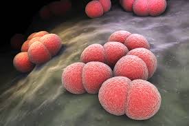 Also, find out how meningitis spreads. Meningitis Definition Symptoms Treatment Facts Britannica