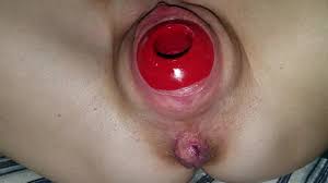 Lg Kong Birthing: Sex Toy Sex Toy Porn