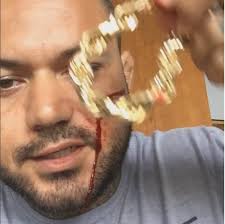 Interesting how court's in Hilo are using this guy Sean Kobayashi as their  star witness . . Clearly a hard drug user.... He attacked an elder in his  own home -- and