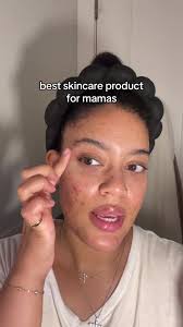 lets just say that the @SpoiledChild x Jeremy Scott wellness eye cream  collab is coming in clutch for these designer bags😂🤌🏽✨ #spoiledchild  #jeremyscott #wellness #eyecream #skincare #momsoftiktok ...