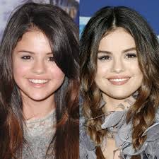 Carrefour Dentaire De Montréal