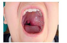 Viral dynamics and immunologic events. Epstein Barr Virus Este Pozitiv Pentru Un Copil InfecÈ›ia Cu Virusul Epstein Barra La Copii AbordÄƒri Moderne Pentru Diagnostic È™i Tratament