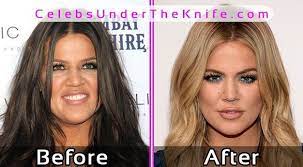 Khloe Kardashian Plastic Surgery Photos Before After Celebsund Khloe Kardashian Plastic Surgery Kardashian Plastic Surgery Kourtney Kardashian Plastic Surgery
