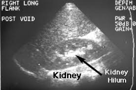 G U Development Ultrasound Info