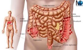 La dieta per chi soffre di diverticoli Diverticolite E Diverticolosi Sintomi Diagnosi E Trattamento Medicina Online