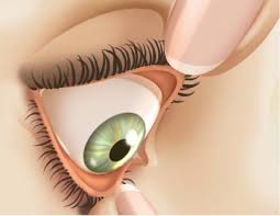 They're comfortable and they don't move around. Https Coopervision Com Sites Coopervision Com Files Pib01041 Sofmed Breathables Xw Rev A Pdf