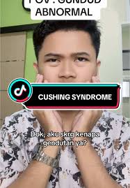 Moon Face dan Cushing Syndrome: Kenali Gejalanya
