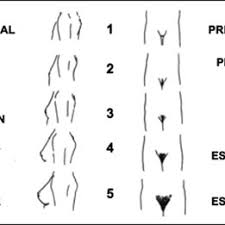 tanner scale for categorizing pubertal breast development