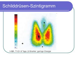 90.000 stichwörter und wendungen sowie 120.000 übersetzungen. Medizinische Begriffe Und Untersuchungsverfahren Ppt Video Online Herunterladen