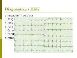 Klinika kardiologie ikem poskytuje nejkomplexnější péči o pacienty se srdečními a cévními chorobami v české republice. Ppt Plicni Hypertenze A Plicni Embolie Powerpoint Presentation Free Download Id 5190017