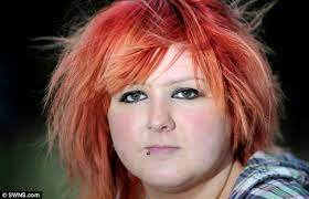 I Cut Myself With Knives In My Sleep Woman 22 Finally Finds Cure For Bizarre Disorder That Left Her Severely Injured Daily Mail Online