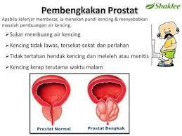 87% pesakit pr0stat dan buah pinggang berpunca daripada kencing m4nis. Set Kencing Tak Lawas Shaklee Pengedar Shaklee Shah Alam