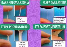 Tipos De Flujo Vaginal Y Sus Significados
