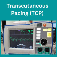 Image result for Transcutaneous Pacing