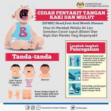 Cox a16 is an abbreviation for coxsackie virus a16. Tips Elakkan Penyakit Hfmd Cerita Huda By Huda Halid