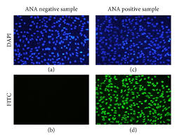 Image result for ANA Staining Pattern