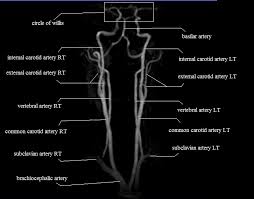 Veins of the head and neck. Neck Arteries Mra Neck Arteries Anatomy