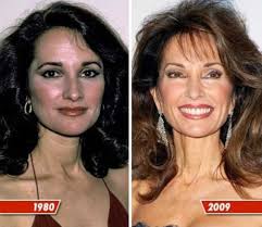 Celebrity Plastic Surgery Before After 56 Pics Celebrity Plastic Surgery Bad Celebrity Plastic Surgery Celebrity Surgery