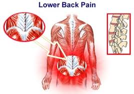 An injury to muscle or ligament is the cause of almost all sorts of low back injuries. Low Back Pain Relief Nevada Pain Las Vegas Henderson